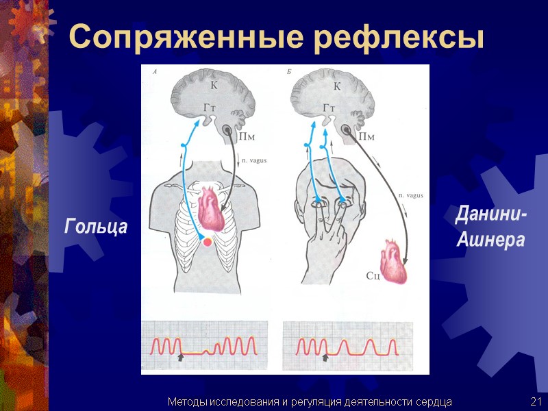 Сопряженные рефлексы Гольца Данини- Ашнера 21 Методы исследования и регуляция деятельности сердца